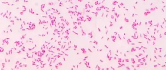 Doxycycline online | Shaanxi BLOOM Tech Co., Ltd Doxycycline online | Shaanxi BLOOM Tech Co., Ltd